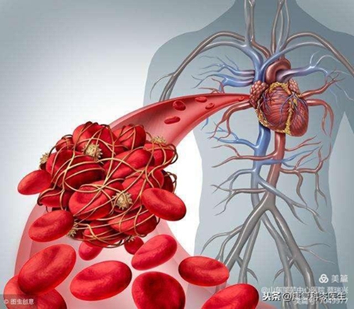 腿腫莫忘了他2.jpg 腿腫莫忘了他2.jpg